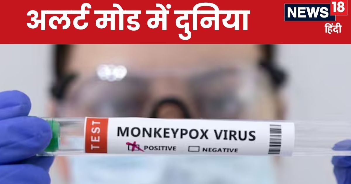 Monkeypox: कोरोना की तरह डराने लगा मंकीपॉक्‍स! अब तक 100 की मौत, अफ्रीका के बाहर भी मिला मरीज